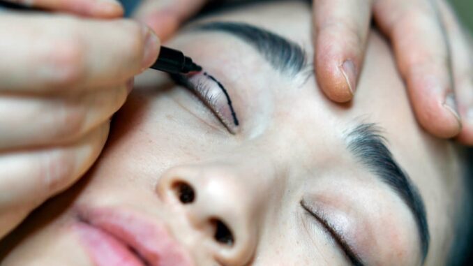 blefaroplastia chirurgia pleoapelor